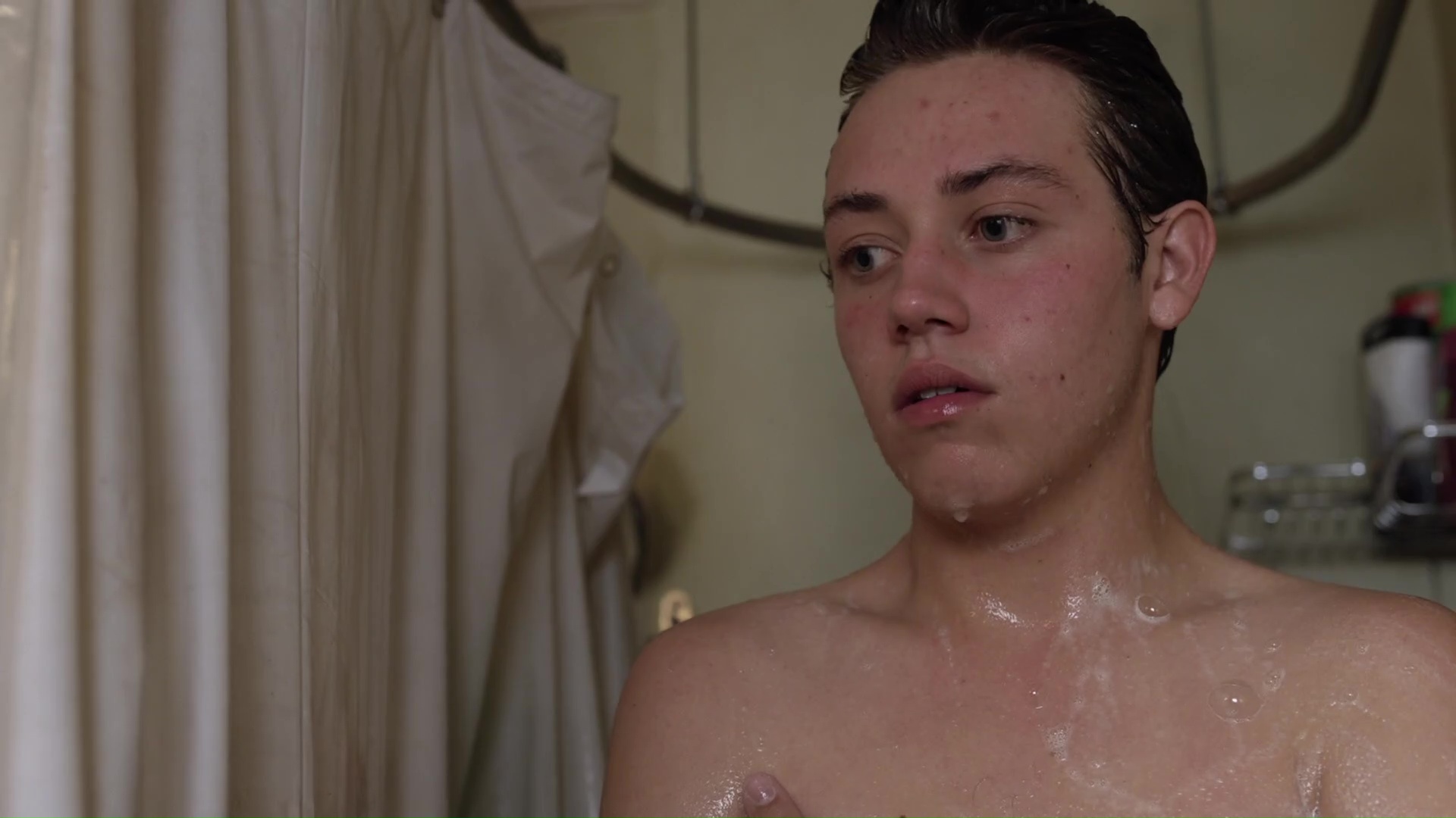 Carl gallagher circumcision